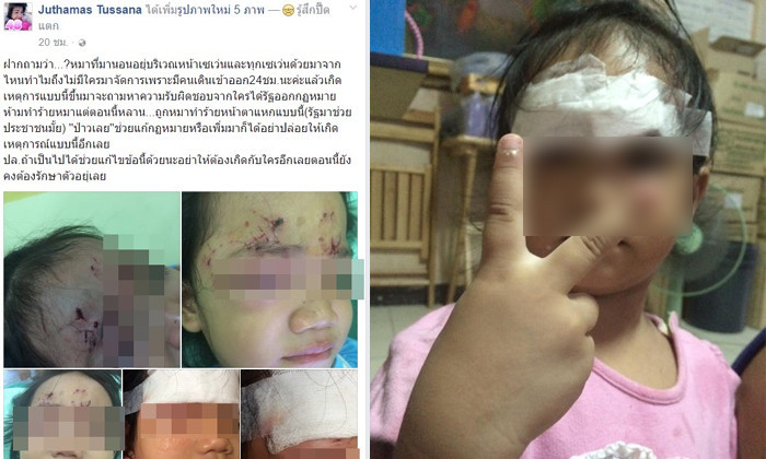 เด็กหญิง 3 ขวบ ถูกสุนัขหน้าร้านสะดวกซื้อ งับหน้าแหก